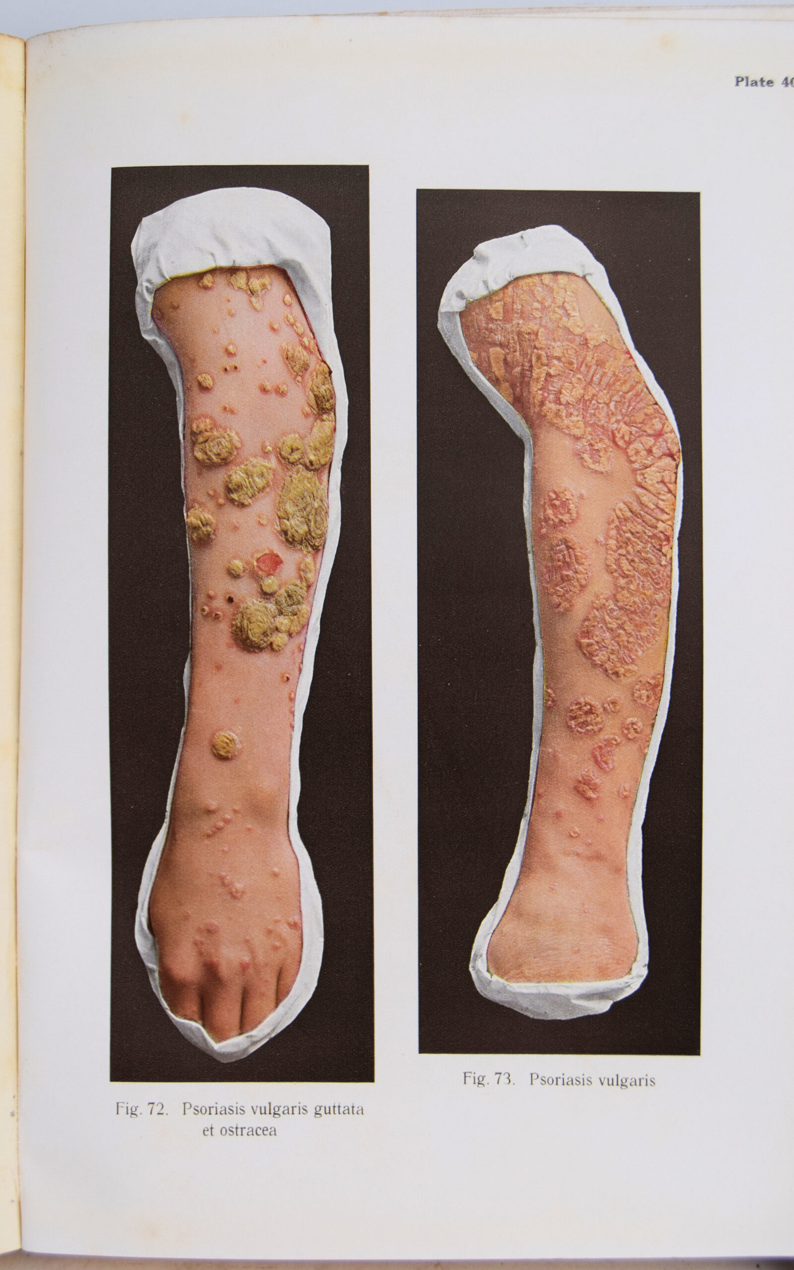 JACOBI'S ATLAS OF DERMOCHROMES.. - Image 3